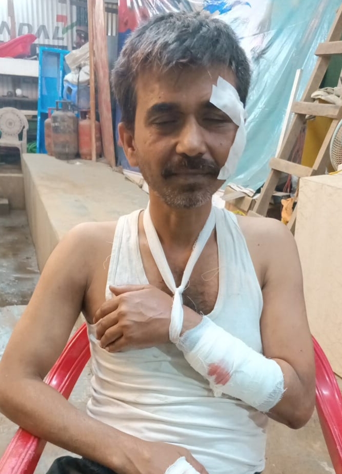 Tripura Crime: লজ্জার সুশাসন!ভাটি অভয়নগরে দিন দুপুরে রক্তাক্ত ইঞ্জিনিয়ার।অপরাধী পুলিশের হটলিস্টে থাকা “জান”।