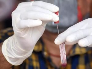 Gujrat Chandipura virus: চান্দিপুরা ভাইরাসের থাবা গুজরাতে। ২২ শিশুর মৃত্যু।